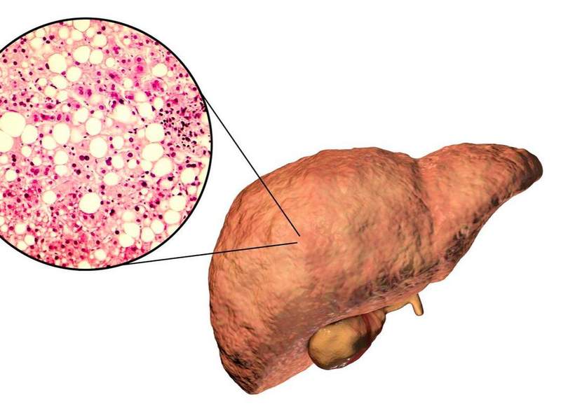  代谢自噬视角：轻断食如何实现肝脏脂肪精准调控的技术解密 健康养生